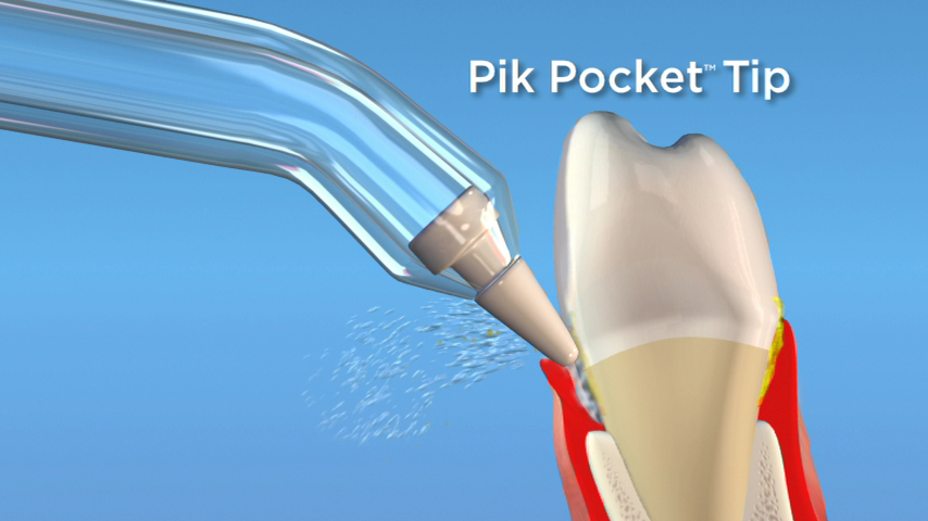 Pik Pocket